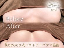 ロココ 水戸店(Rococo)/BEFORE/AFTER