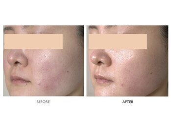 サロンドオフ 御堂筋店(salon de off)/