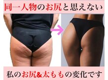 マール(Mar)