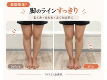 スリー治療院 伏見桃山(THREE治療院)の雰囲気（美脚整体｜脚だけ細くならない・夕方は脚がパンパン・むくみに◎）