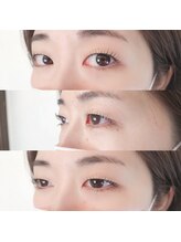 ジュピ(Jupi)/まつげパーマ