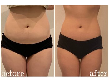 エニ 恵比寿(eni)/お腹周りのビフォーアフター