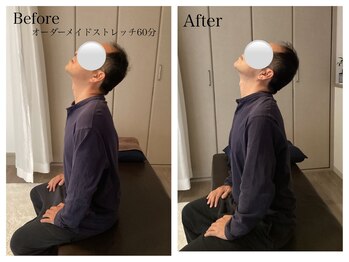 ワン ストレッチ(ONE stretch)/50代男性before・after