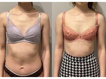 ティアモ(Ti Amo)/授乳後でも2カップUP！