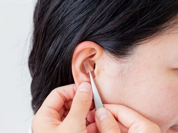 カナエル(Kanaeru)の写真/【痩せたいアナタへ】耳つぼは高い成功率！どんなダイエットでも挫折した方に◎まずはカウンセリングから♪