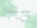 施術前・施術後