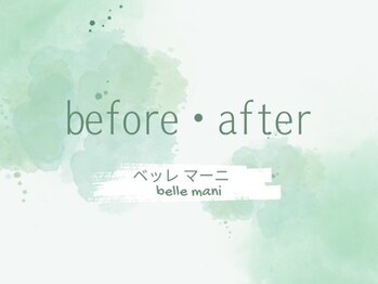 ベッレ マーニ/施術前・施術後