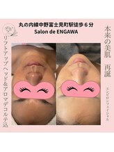 サロンドエンガワ(Salon de ENGAWA)/エンビロンフェイシャル