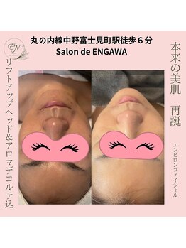 サロンドエンガワ(Salon de ENGAWA)/エンビロンフェイシャル