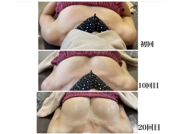 ロココ 豊田店(Rococo)/ビフォーアフター