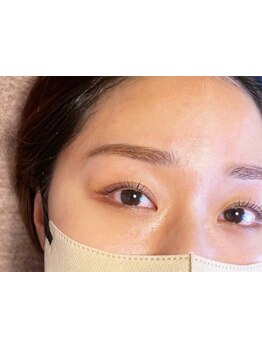 顔脱毛がしたい