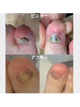 フットケア蘇 辛島店(SO)