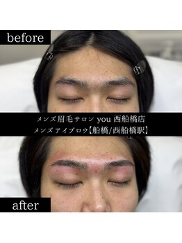 ユー 西船橋店(you)/ビフォーアフター写真