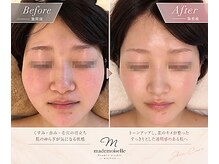 マドモアゼルメゾン 恵比寿(マドモアゼルMaison)