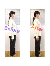 セブンベルズ美容整体/【小顔矯正】　60分×４回