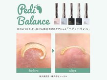 ミイア 春日部店(MiiA)/巻き爪改善ジェル　初回¥8,800