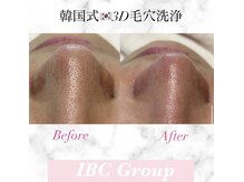 トータルサロンアイビーシー(トータルサロンIBC)/大人気！ 毛穴洗浄