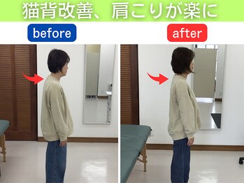 リハスル(REHASUL)/猫背・巻き肩改善！