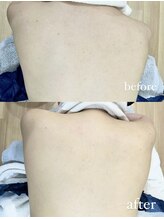 サロン スリーバイエス(salon THREE/S)/背中ビタミン×ポテンツァコース