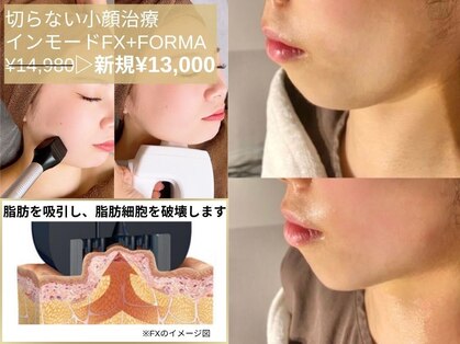 ルディラ 銀座店の写真