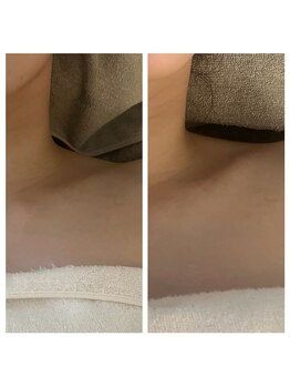 美温(mion)/デコルテケア