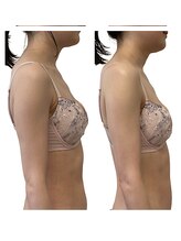 ベンザイ 梅田店(BENZAI)/ストレートネック、デコルテケア