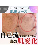 エステティックサロン ラ アクア(ra aqua)/二人三脚で歩む肌育結果はコチラ