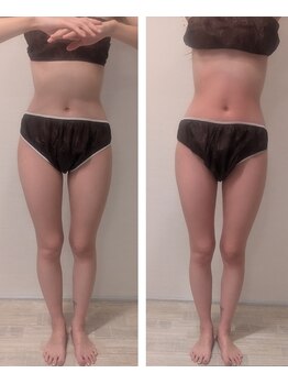 ムーンブロッサム(MoonBlossom)/脂肪撃退痩身脚+上半身120分