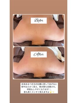 アンベリール(Embellir)/巻き肩・猫背解消!