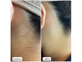 シャルム 広島店(CHARME)/うなじwax♪