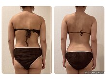 ボーテ(beaute)/【ビフォーアフター】