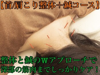 なごみの森接骨院 コーナン鎌倉大船院/【肩こり/首整体+鍼コース】