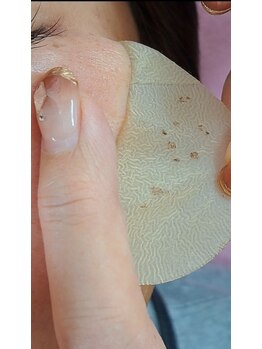 シミしわ改善！予防ケア