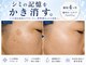 プレナ(PLENA)の写真