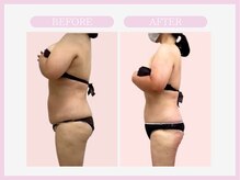 スリムライン 青森店(The Slim Line)/before→after