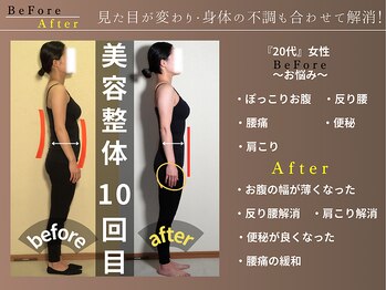 カケル(KAKERU)/産後の骨盤矯正♪