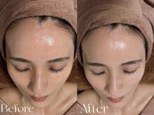 ウィハナ(wehana)/セラピールで透明感アップ