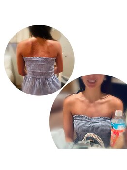 ロータス(Lotus)/背中・デコルテ出しが得意サロン