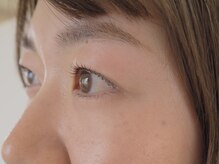 スーコ アイビューティー(suco)/