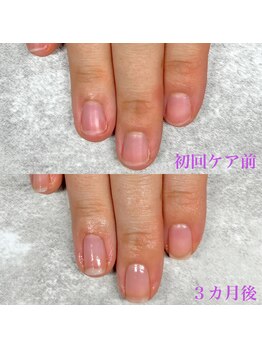 ネイルエリザベス(Nail Elizabeth)の写真/ジェル不使用で美爪になれる☆経験豊富なスタッフが爪の状態を見極めしっかりカウンセリングいたします◎