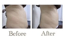 ベリーザプラス(Belliza+)/上半身もお任せ下さいませ!