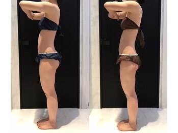 リボディ 表参道(An re Body)/before→after