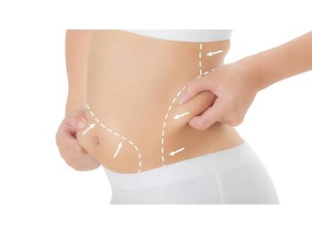 ヨサパーク グランス(YOSA PARK glans)/〇〇を細くしたい！も、お任せ☆