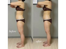 エヌボーテ(N. beaute)/before→after1回目