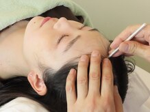 かつらはりきゅう 小児しん