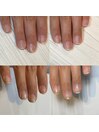 たった1回の施術で変化する育成