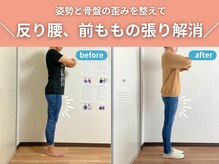整体院カイト/【反り腰・前ももの張り】