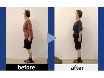 浜松整体 理学ゼーション 富塚店/ビフォーアフター