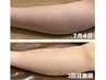 【口コミ割】膝下毛孔性【膝下・ふくらはぎ】ハーブ★1ｇ¥7800～