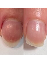 ルクレール カシェット(Le clair cachette)/美爪育成コース